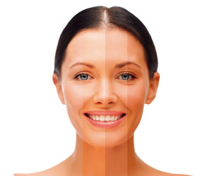 Velform Tanning 2x1 a 248 LEU