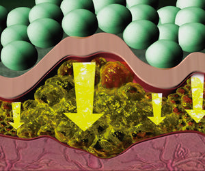 CelluNO kit a 49,99€